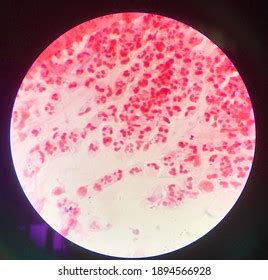 Bacteria Cells Gram Stain Stock Photo 1894566928 | Shutterstock