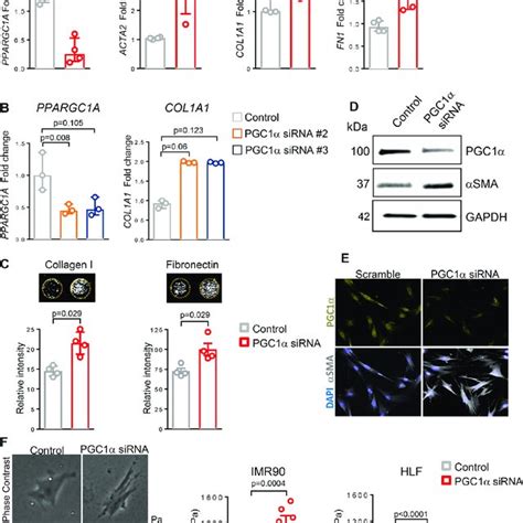 Peroxisome Proliferator Activated Receptor Gamma Co Activator Alpha