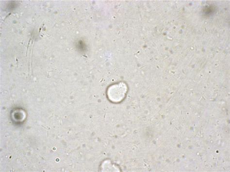 Amoeboid And Granular Forms Of Blastocystis Hominis In Stool Culture Download Scientific