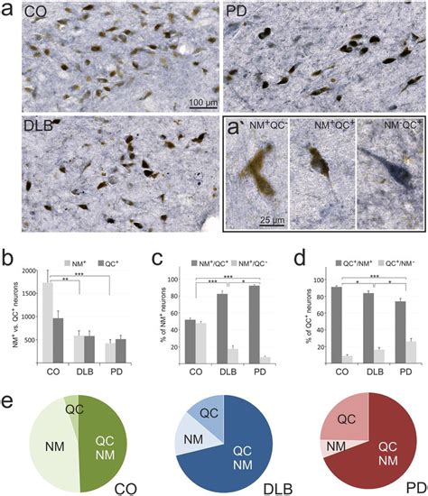 Qc In Human Sn Relation To Neuromelanin A Typical Examples Of Download Scientific Diagram