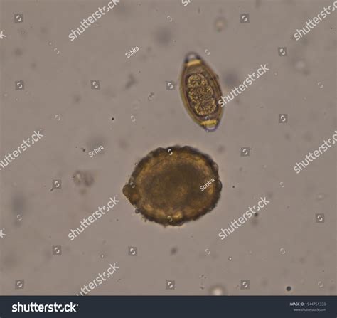 Mixed Ascaris Lumbricoides Trichulis Trichiura Egg Stock Photo