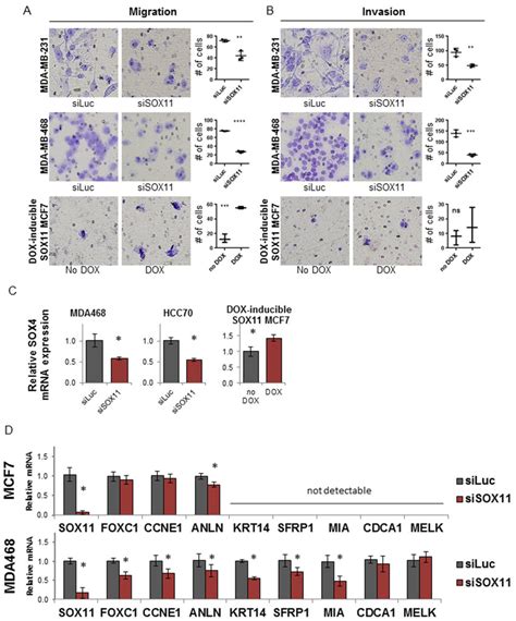 Sox Is A Critical Regulator Of Migration Invasion And Blbc Gene