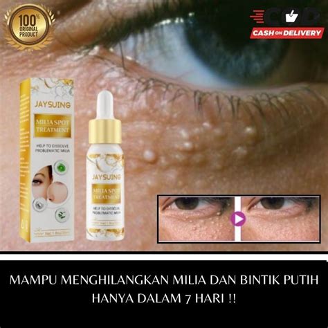 Jual Krim Penghilang Milia Dibawah Mata Perontok Milia Shopee Indonesia