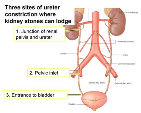 Urology Flashcards Quizlet