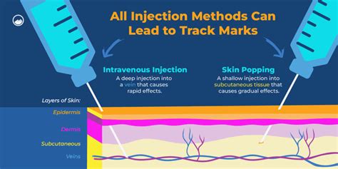 Track Marks: What They Look Like & How to Recover