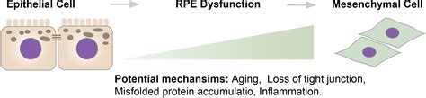 Frontiers Role Of Epithelial Mesenchymal Transition In Retinal