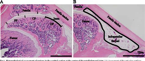 Figure 1 From Induction Of Osteoarthritis By Injecting Monosodium