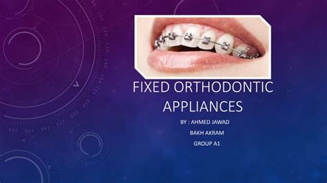 Fixed Orthodontic Appliances Ppt