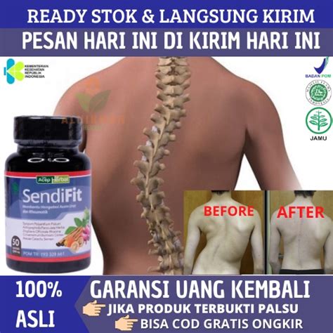 Jual Obat Skoliosis Obat Herbal Untuk Skoliosis Obat Tulang