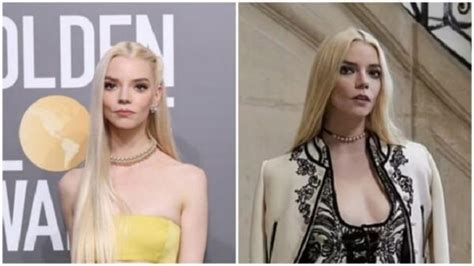 Anya Taylor-Joy Before and After Plastic Surgery