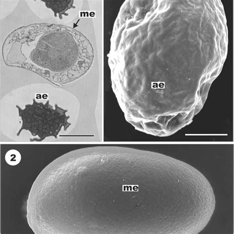 Semithin Section Showing Normally Developing Mature Egg Of Eubothrium Download Scientific