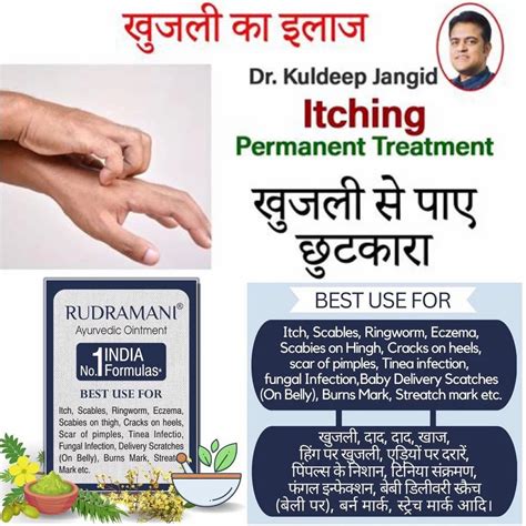 Rudramani Ayurvedic Anti Fungal Malam For Ringworm Itching Eczema