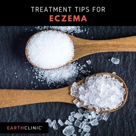 Effective Natural Eczema Treatments for Soothing Relief