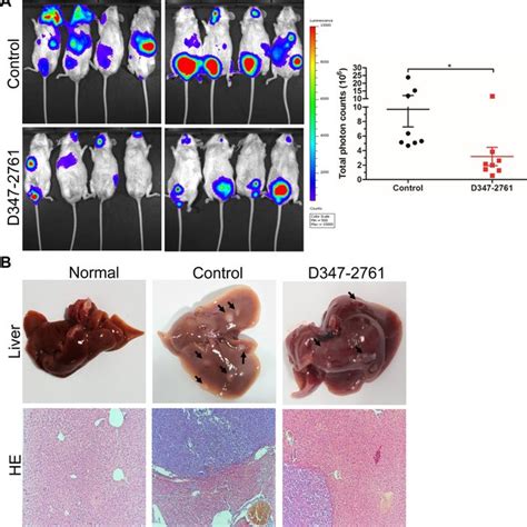 D Repressed Myeloma Distal Infiltration A Nsg Mice Were