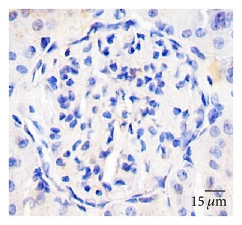 Aqp1 And Hsp60 Expression In The Glomeruli Immunohistochemical