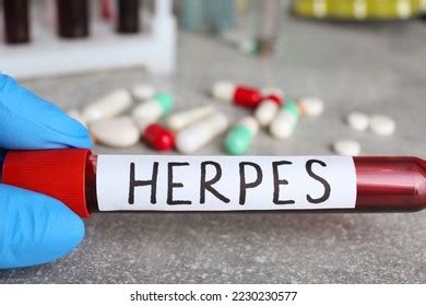 Herpes Simplex Prevention Photos and Images | Shutterstock