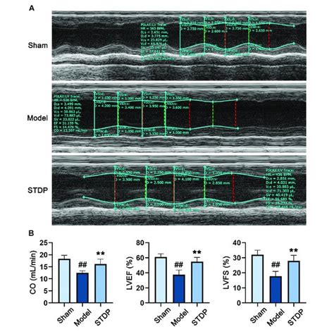 Stdp Relieves Tac Induced Cardiac Dysfunction In Chf Mice A