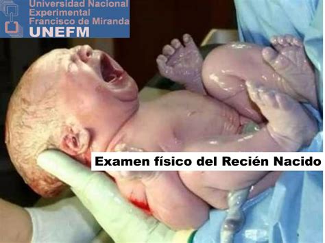 Examen Fisico Del Recien Nacido PPT