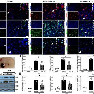 The Effects Of RCCL17 Treatment On Microglia Macrophage Activation And