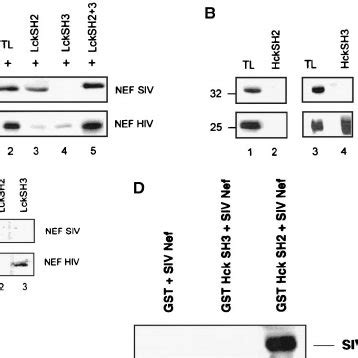 GST Fusion Proteins Of HIV 1 But Not SIV Nef Bind Hck And Lck SH3