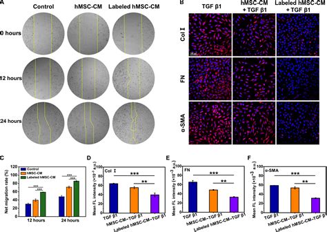 Enzyme Like Nanoparticleengineered Mesenchymal Stem Cell Secreting Hgf