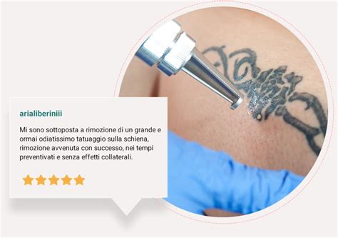 Rimozione Tatuaggi Con Laser Brescia Biosphera Med