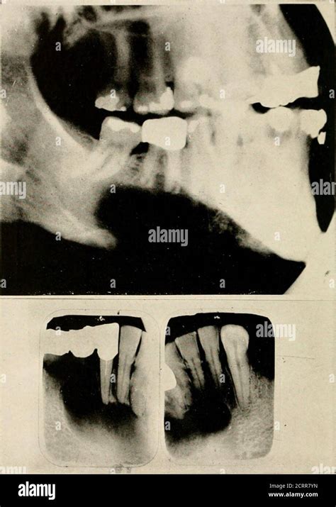 Radiografía dental y oral un libro de texto para estudiantes y