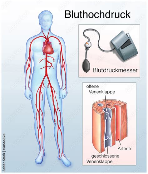 Bluthochdruck Blutkreislauf Arterien Stock Illustration Adobe Stock