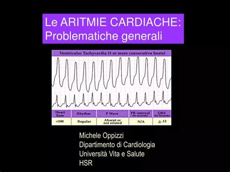 Ppt Le Aritmie Cardiache Problematiche Generali Powerpoint