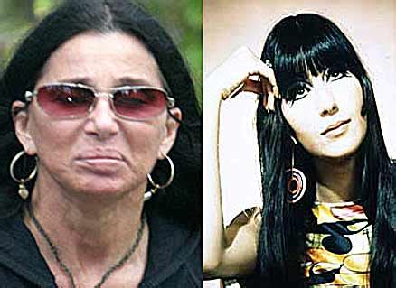 Cher Plastic Surgery Before and After Nose Job and Breast Implants ...