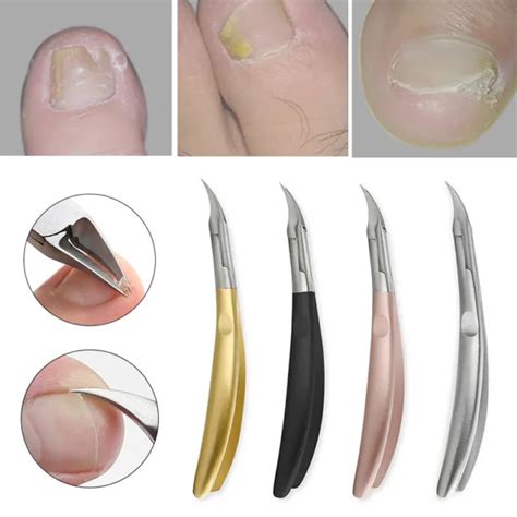 Ongle Incarn Pince Ciseaux Cuticules Paronychia Outil Coupe Ongles