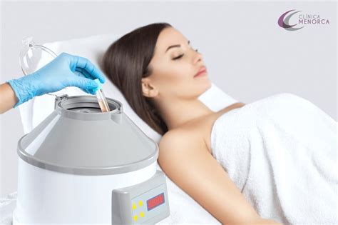 Prp facial para qué sirve el plasma rico en plaquetas que arrasa