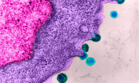 Healthy Gay Men Must Be Given HIV Treatment To PREVENT Infection Daily Mail Online