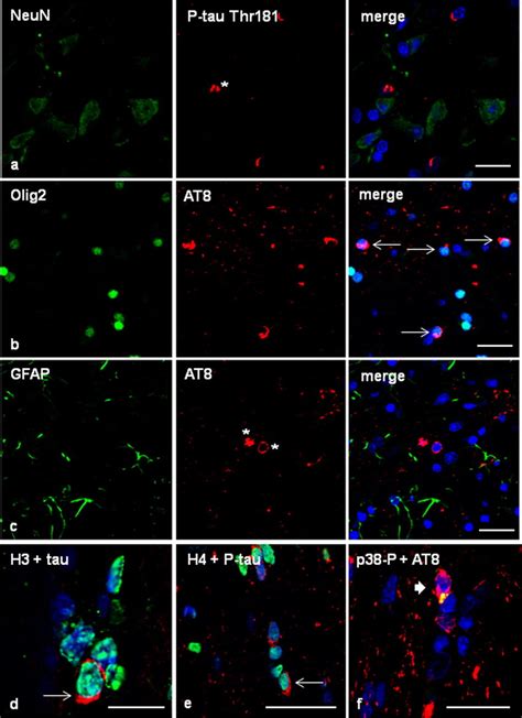 Ac Double Labelling Immunofluorescence And Confocal Microscopy To