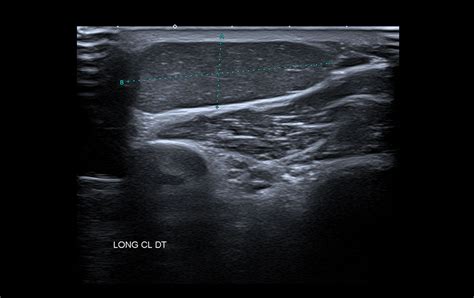 Dr Mazzamuto Centre de radiographie à Jodoigne Echographie doppler