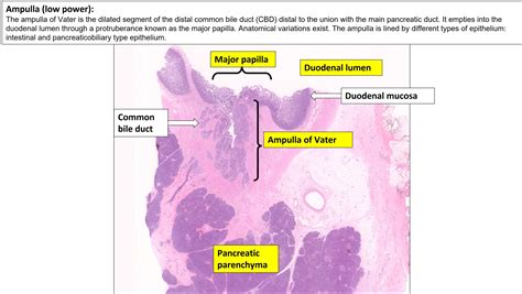 Ampulla Normal Histology Nus Pathweb Nus Pathweb