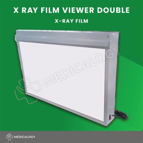 Jual Alina X Ray Film Viewer Double Lampu Baca Rontgen X Ray