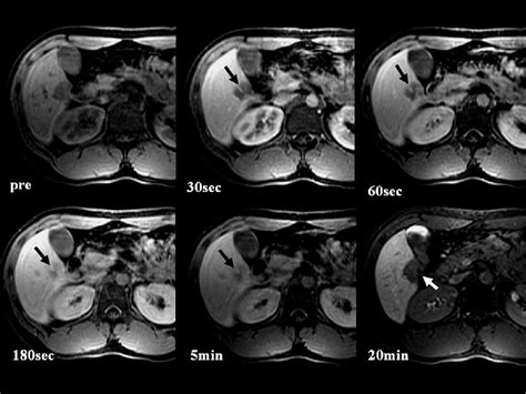 Figure 4 From Computed Tomography And Magnetic Resonance Imaging