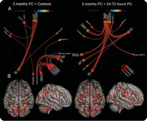Region To Region Hyperconnectivity At 3 Months Download Scientific Diagram