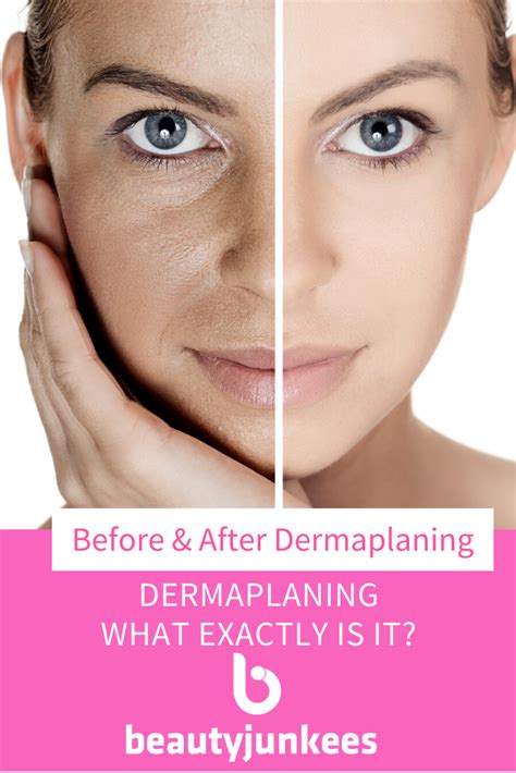 Dermaplaning Hair Regrowth Time Mertie Martel