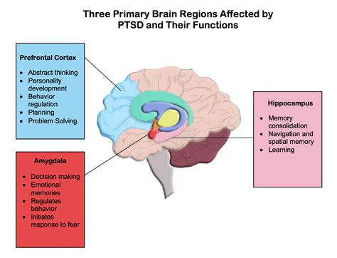 PTSD AND TMS A GREAT COMBINATION - Creative Solutions