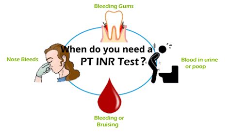 PT INR Test Price Purpose Procedure And Normal Range