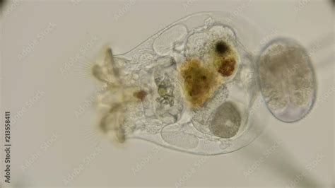 Brachionus Plicatilis Rotifer How It Feeds And How Microorganisms Get