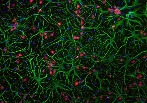 Troubleshooting Fluorescence Microscopy Experiments | The Scientist ...