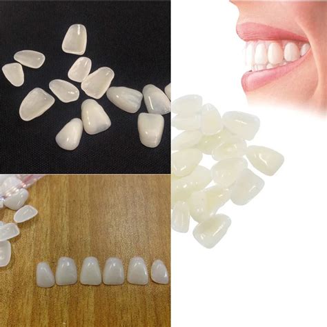 Facettes Dentaires Ultra Minces Blanchiment Des Dents En Résine Dents