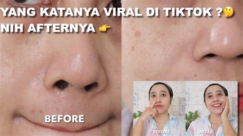 Nggak Perlu Skincare Cara Mengecilkan Pori Pori Wajah Secara Alami