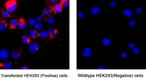 Human Siglec 3 CD33 LlamabodyTM VHH His Tag Antibody LMAB10752 Bio