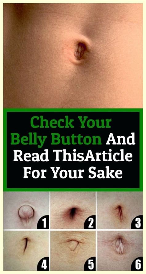 outie belly button
