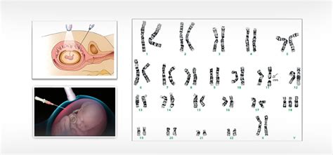 First Trimester Ultrasound Course - Bangalore, India