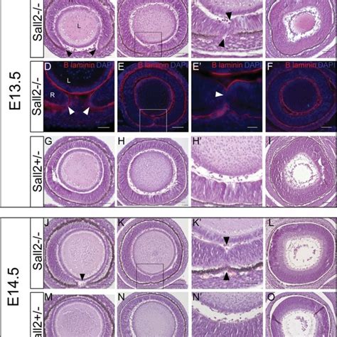 Histological Analysis Of Eyes Dissected From P Sall Mice Top